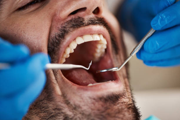 Best Weekend Emergency Dental Services in Benicia, CA